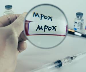 <i>Resultados positivos de la prueba de la sangre de los tubos de recolección de sangre monkeypox (MPOX). FOTO QINQIE99 / Shutterstock</i>