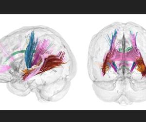 <i>Hasta ahora, la ciencia había descrito los cambios fisiológicos en el cerebro de la mujer durante el embarazo pero no tanto los neuronales. FOTO EFE</i>